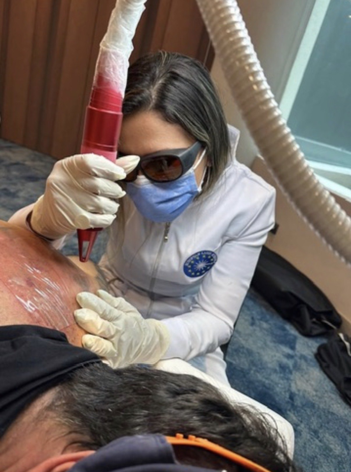 Remoção de micropigmentação de sobrancelhas na Eva Derm