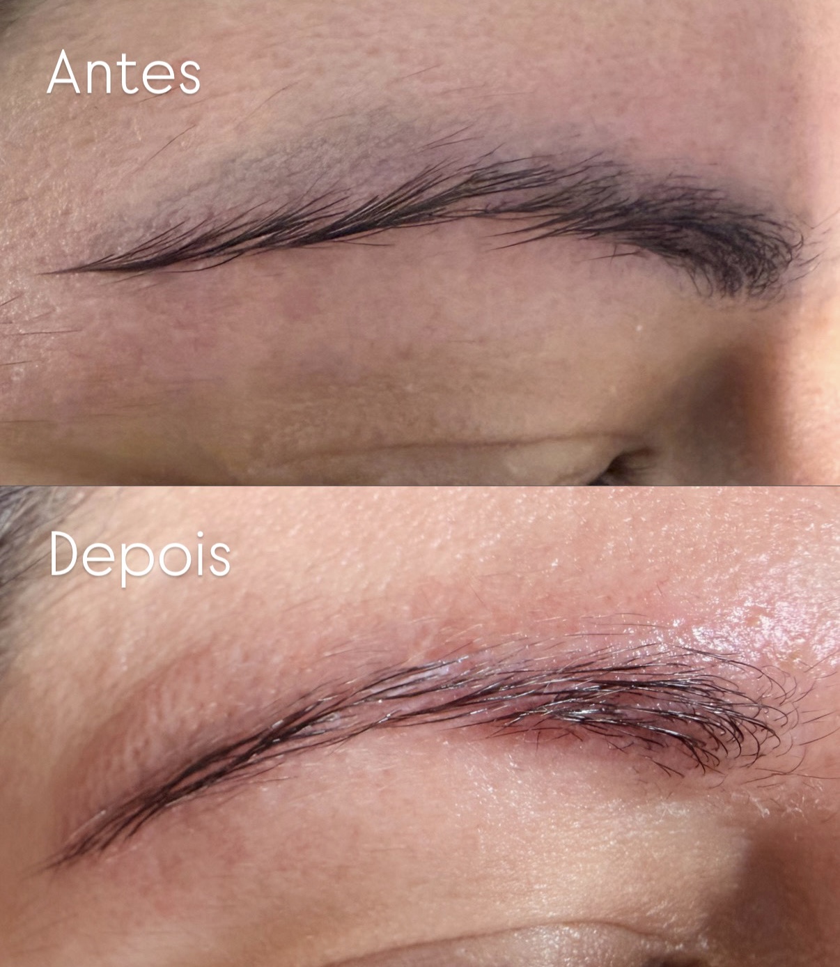 Antes e depois de sobrancelha na Eva Derm