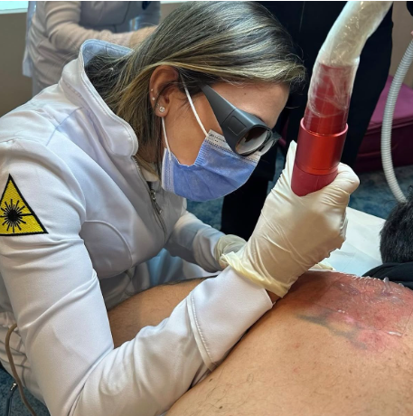 Remoção de tatuagem a laser na Eva Derm