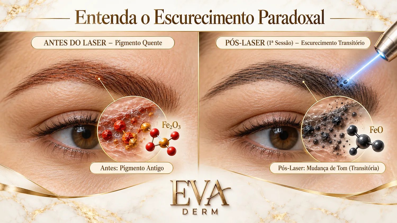 Infográfico EVA DERM sobre o escurecimento paradoxal após laser de micropigmentação