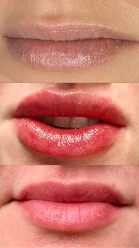 Resultados de micropigmentação labial realizados pela Eva Derm